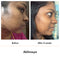 Advanced Pigmentation Serum